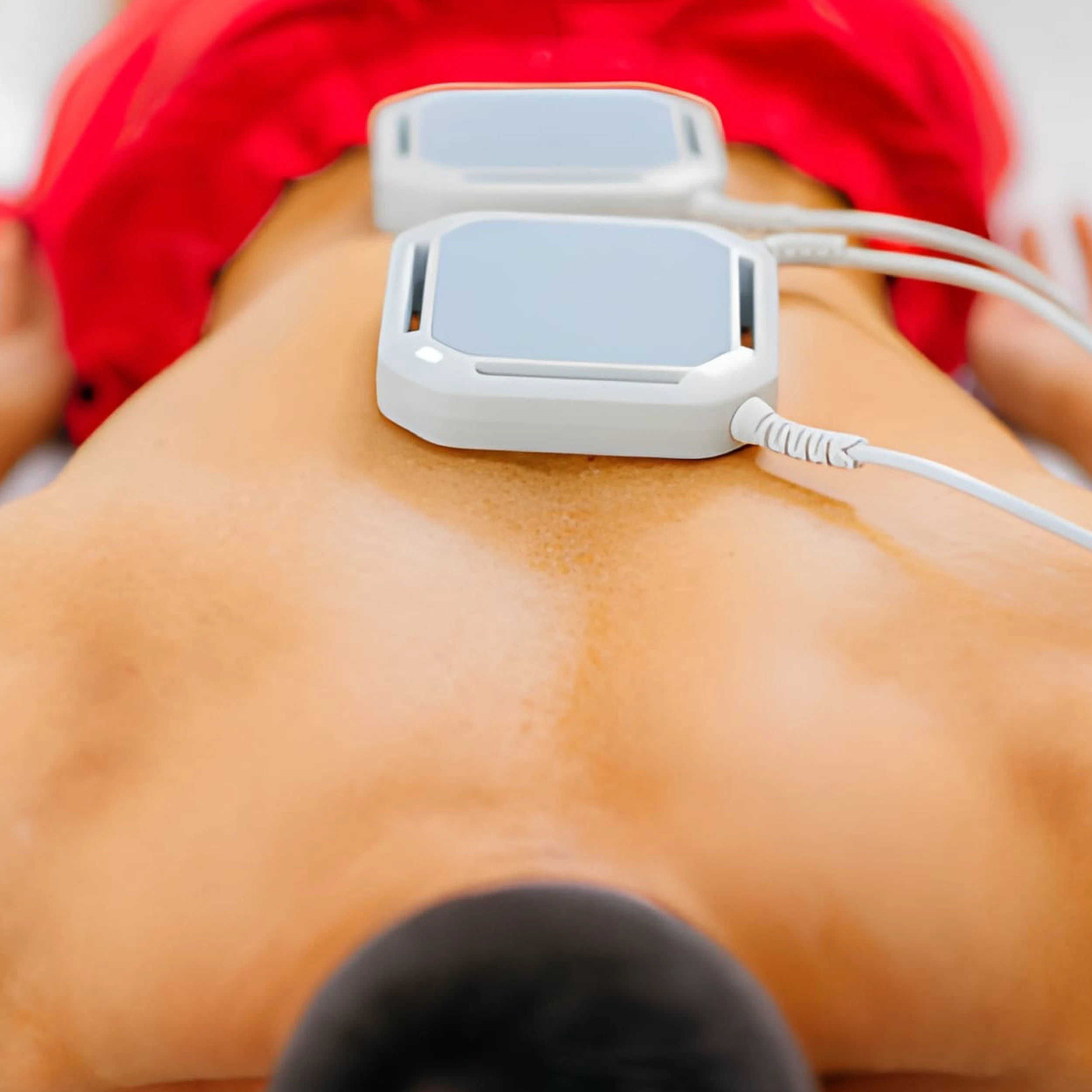 Static Magnet Therapy